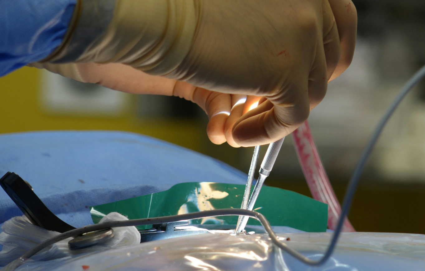 Nahaufnahme der Hände eines Chirurgen, der im Operationssaal einen komplizierten Eingriff durchführt.